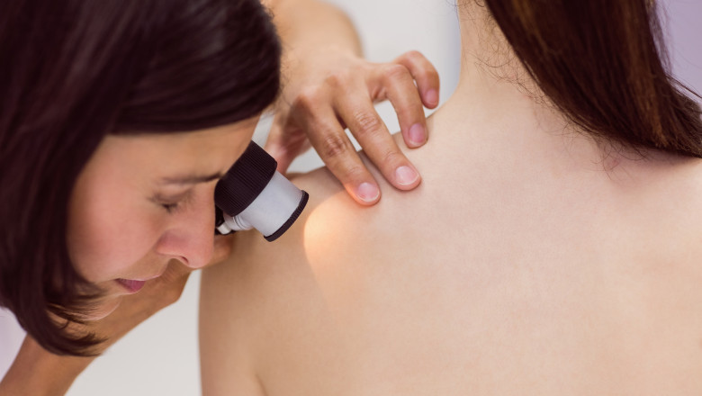 Reveal Radiant Skin: Effective Scar Lightening Solutions Near Boca Raton, FL