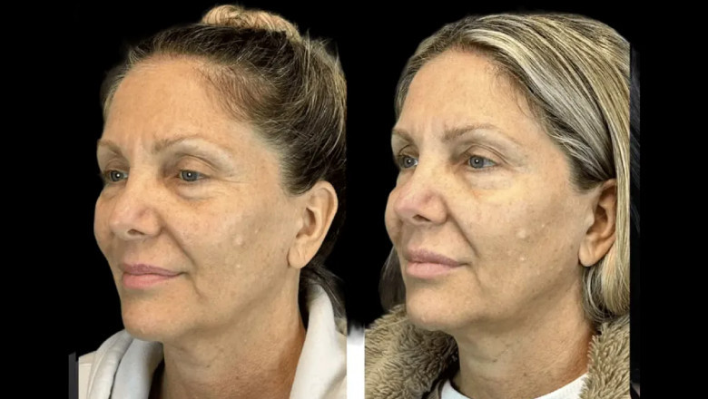 Ultimate Guide to Choosing the Best Aesthetic Clinic in Dubai for Your Skin