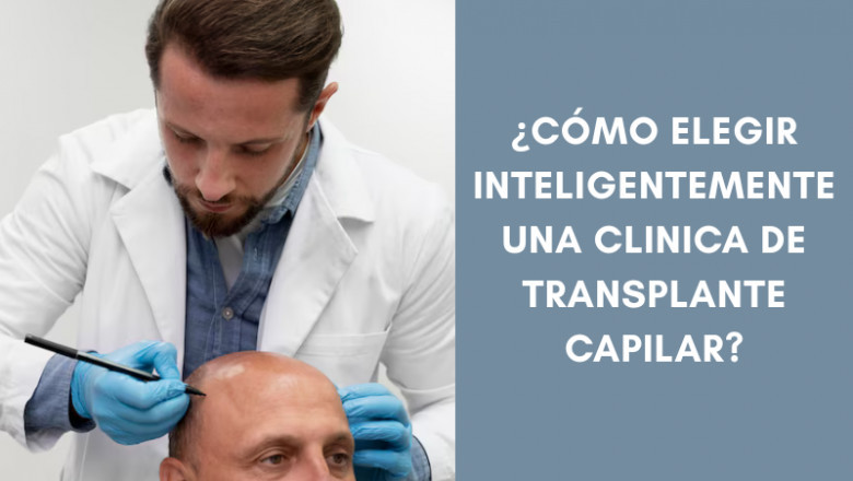 ¿Cómo elegir inteligentemente una clinica de transplante capilar?