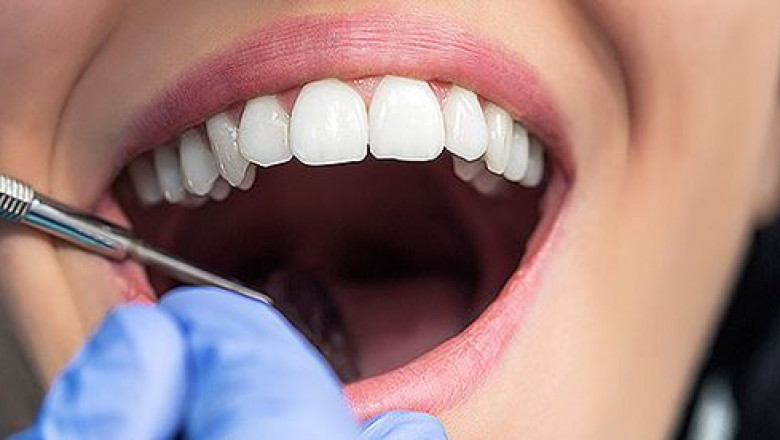 Immediate Dental Relief: Finding the Best Emergency Dentist in Mill Park