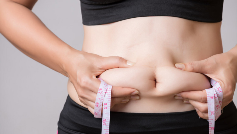 Liposuction Made Simple Tips from Best Liposuction Surgeon in Dubai
